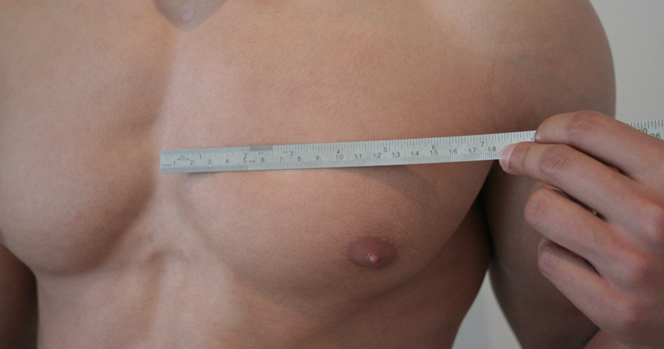 Implants de Pectoraux